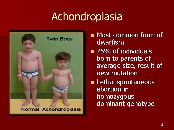 Achondroplasia Most common form of dwarfism n 75% of individuals born to parents of