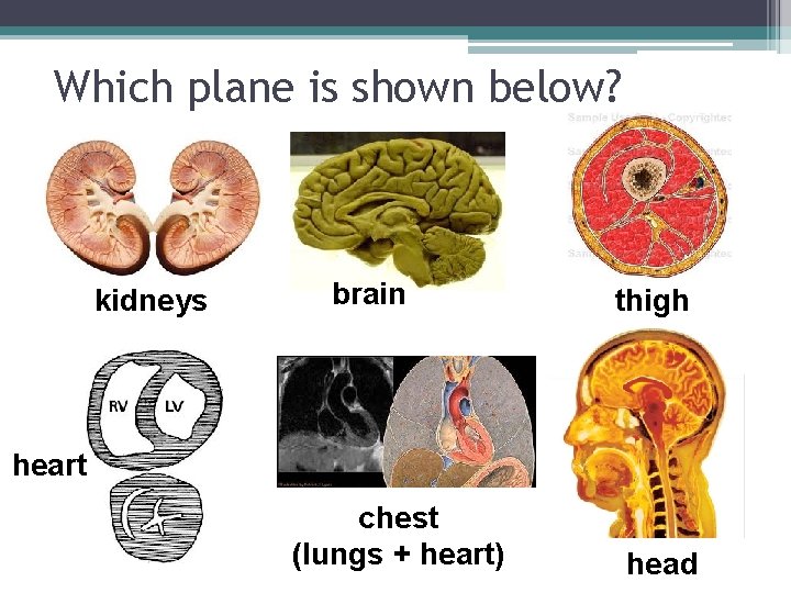 Which plane is shown below? kidneys brain thigh heart chest (lungs + heart) head