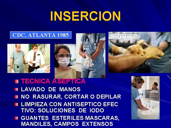INSERCION CDC, ATLANTA 1985 TECNICA ASEPTICA LAVADO DE MANOS NO RASURAR, CORTAR O DEPILAR