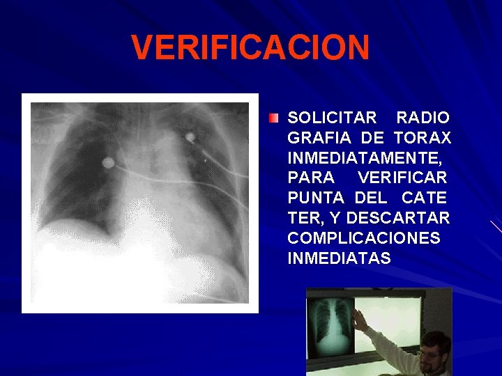 VERIFICACION SOLICITAR RADIO GRAFIA DE TORAX INMEDIATAMENTE, PARA VERIFICAR PUNTA DEL CATE TER, Y