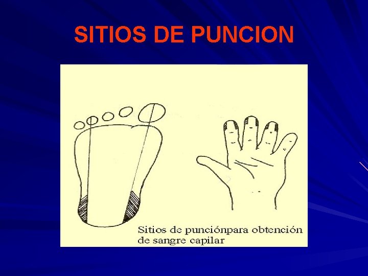 SITIOS DE PUNCION 