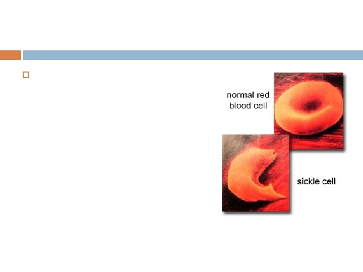 What is Sickle Cell? People who have Sickle Cell have sickle shaped red blood