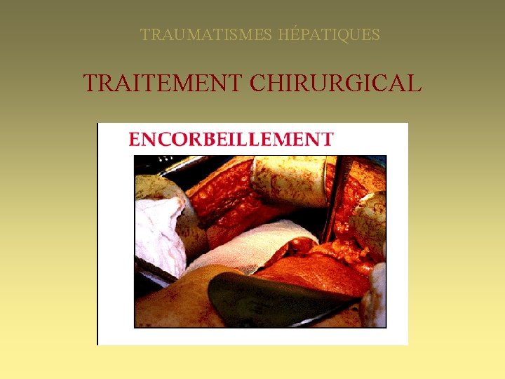 TRAUMATISMES HÉPATIQUES TRAITEMENT CHIRURGICAL 