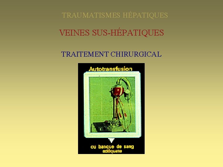 TRAUMATISMES HÉPATIQUES VEINES SUS-HÉPATIQUES TRAITEMENT CHIRURGICAL 