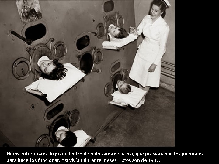 Niños enfermos de la polio dentro de pulmones de acero, que presionaban los pulmones