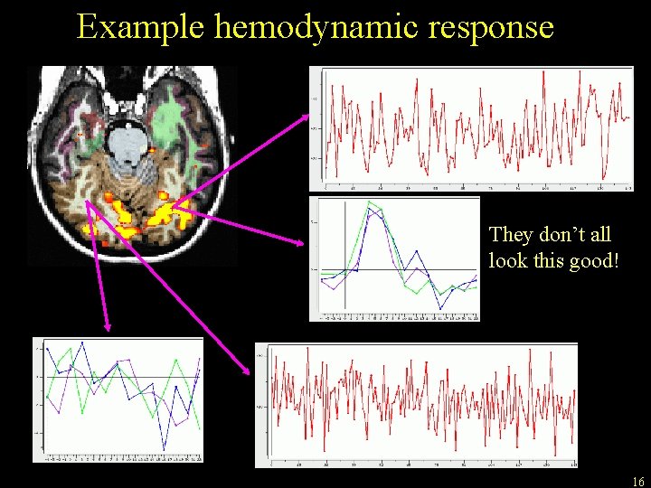 Example hemodynamic response They don’t all look this good! 16 