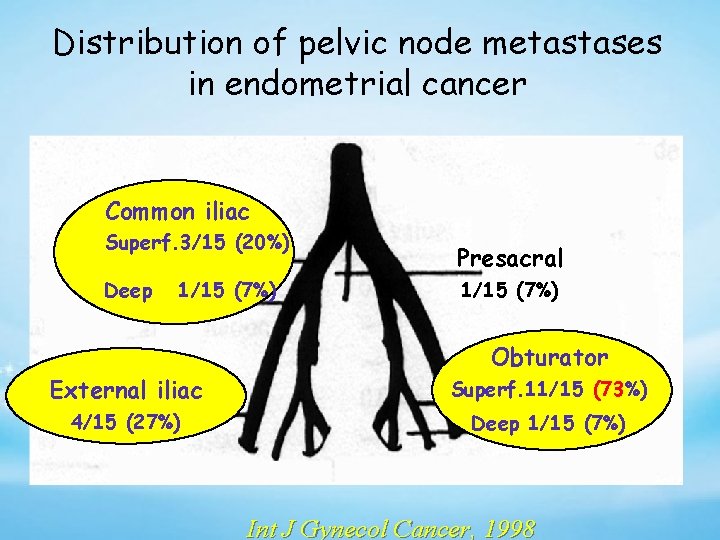 Distribution of pelvic node metastases in endometrial cancer Common iliac Superf. 3/15 (20%) Deep