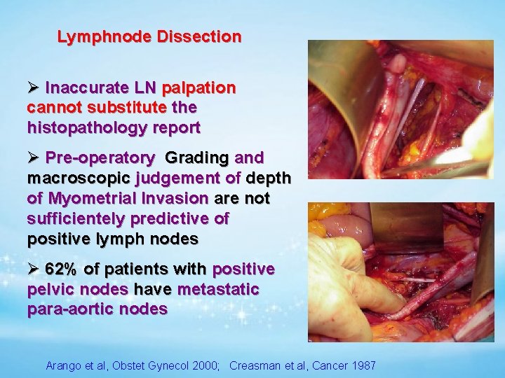 Lymphnode Dissection Ø Inaccurate LN palpation cannot substitute the histopathology report Ø Pre-operatory Grading