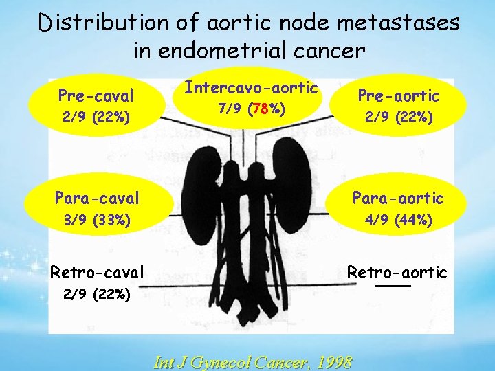 Distribution of aortic node metastases in endometrial cancer Pre-caval 2/9 (22%) Intercavo-aortic Pre-aortic 7/9