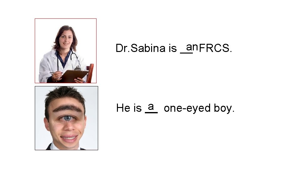 Dr. Sabina is an. FRCS. He is a one-eyed boy. 