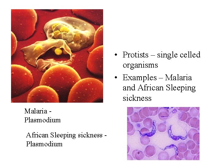  • Protists – single celled organisms • Examples – Malaria and African Sleeping