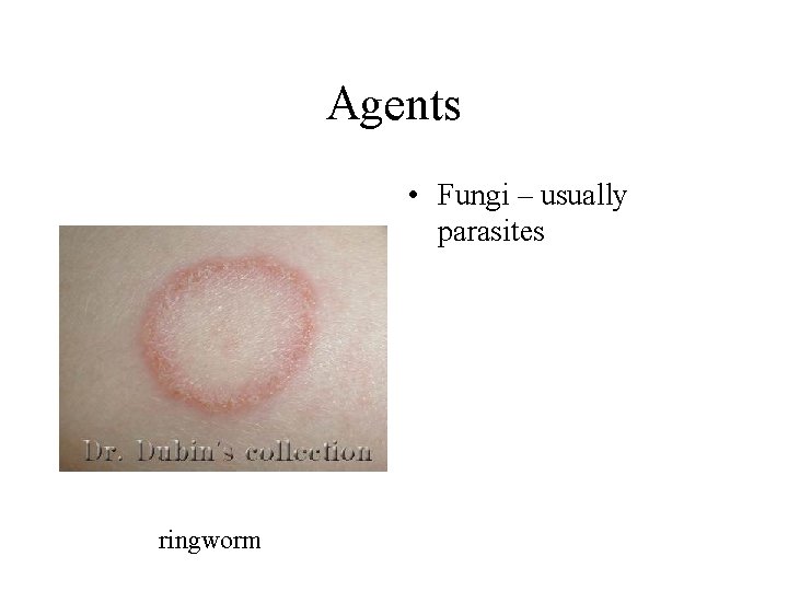 Agents • Fungi – usually parasites ringworm 