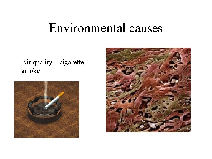 Environmental causes Air quality – cigarette smoke 