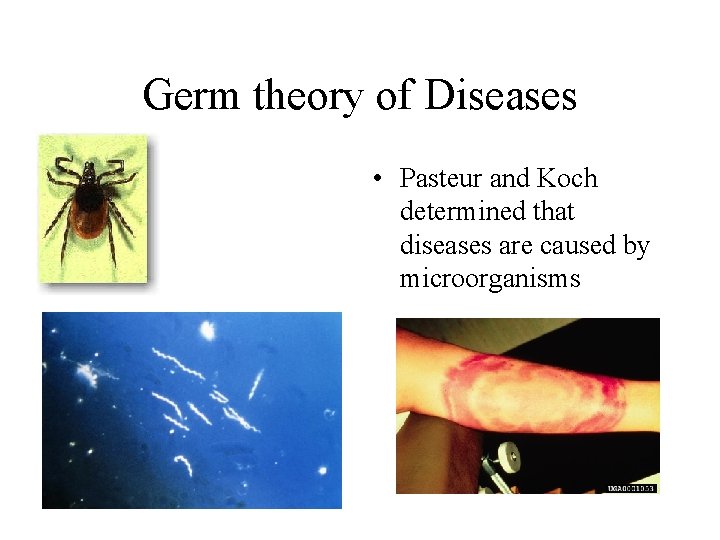 Germ theory of Diseases • Pasteur and Koch determined that diseases are caused by