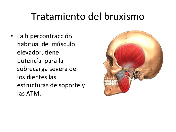 Tratamiento del bruxismo • La hipercontracción habitual del músculo elevador, tiene potencial para la