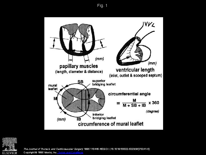 Fig. 1 The Journal of Thoracic and Cardiovascular Surgery 1995 110445 -452 DOI: (10.