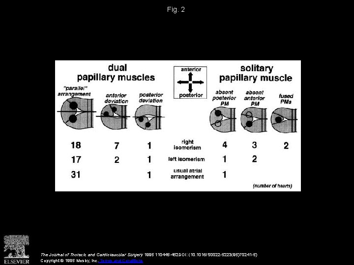 Fig. 2 The Journal of Thoracic and Cardiovascular Surgery 1995 110445 -452 DOI: (10.
