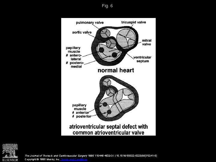 Fig. 6 The Journal of Thoracic and Cardiovascular Surgery 1995 110445 -452 DOI: (10.