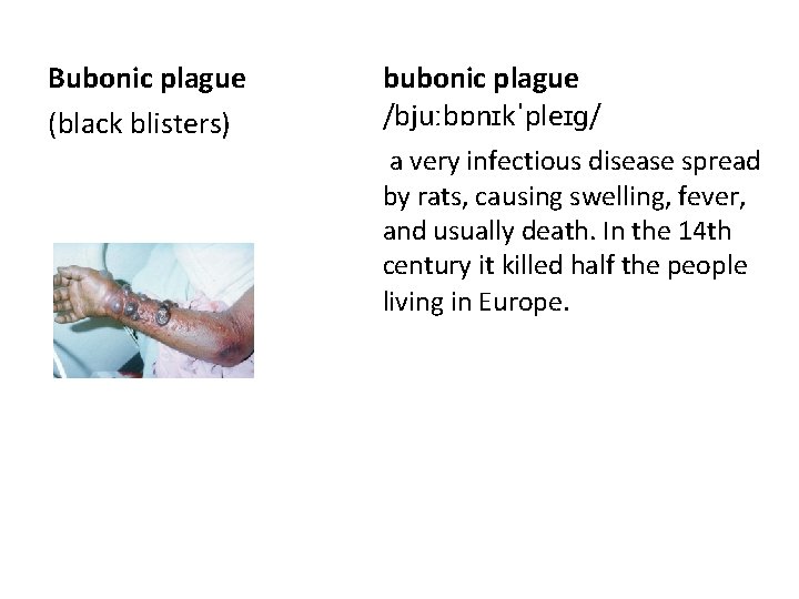 Bubonic plague (black blisters) bubonic plague /bjuːbɒnɪkˈpleɪɡ/ a very infectious disease spread by rats,