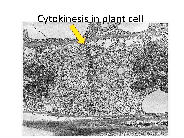 Cytokinesis in plant cell 