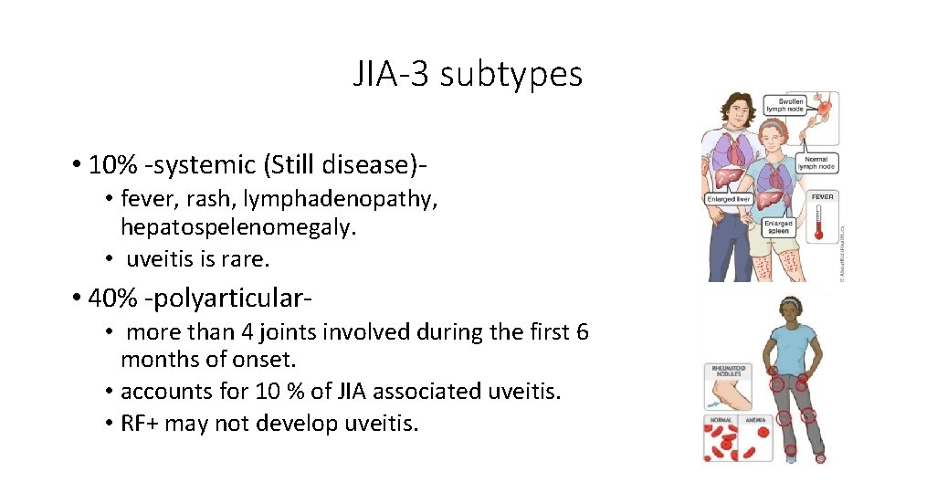 JIA-3 subtypes • 10% -systemic (Still disease) • fever, rash, lymphadenopathy, hepatospelenomegaly. • uveitis