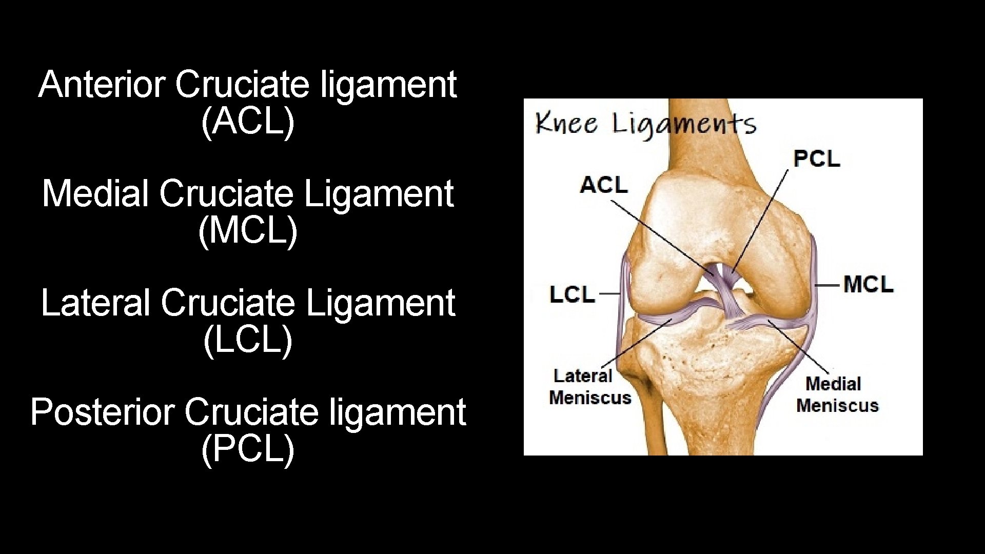 Anterior Cruciate ligament (ACL) Medial Cruciate Ligament (MCL) Lateral Cruciate Ligament (LCL) Posterior Cruciate Anterior Cruciate ligament (ACL) Medial Cruciate Ligament (MCL) Lateral Cruciate Ligament (LCL) Posterior Cruciate