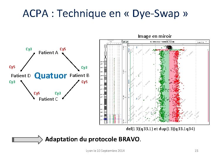 ACPA : Technique en « Dye-Swap » Image en miroir Cy 3 Patient A