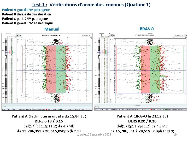 Test 1 : Vérifications d’anomalies connues (Quatuor 1) Patient A grand CNV pathogène Patient