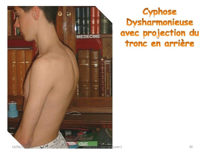 14/06/2021 Université Cl Bernard Lyon 1 29 