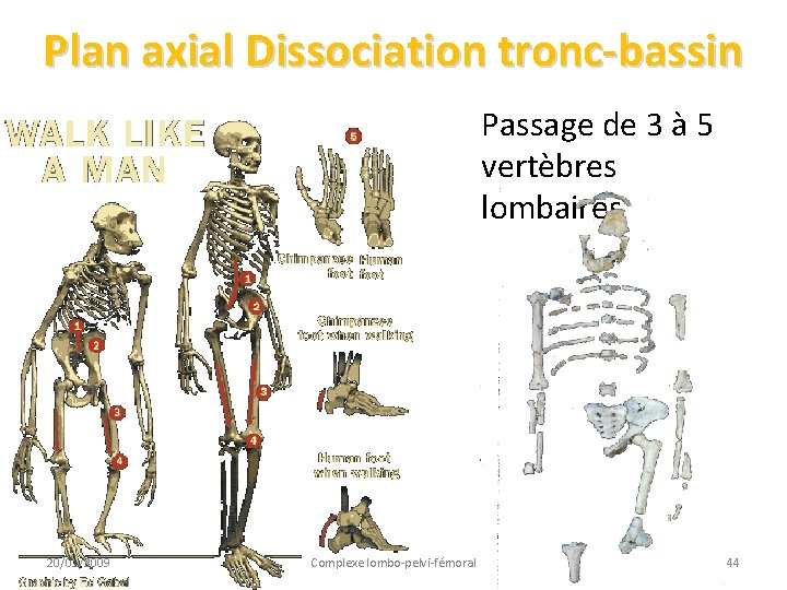Plan axial Dissociation tronc-bassin Passage de 3 à 5 vertèbres lombaires 20/01/2009 Complexe lombo-pelvi-fémoral