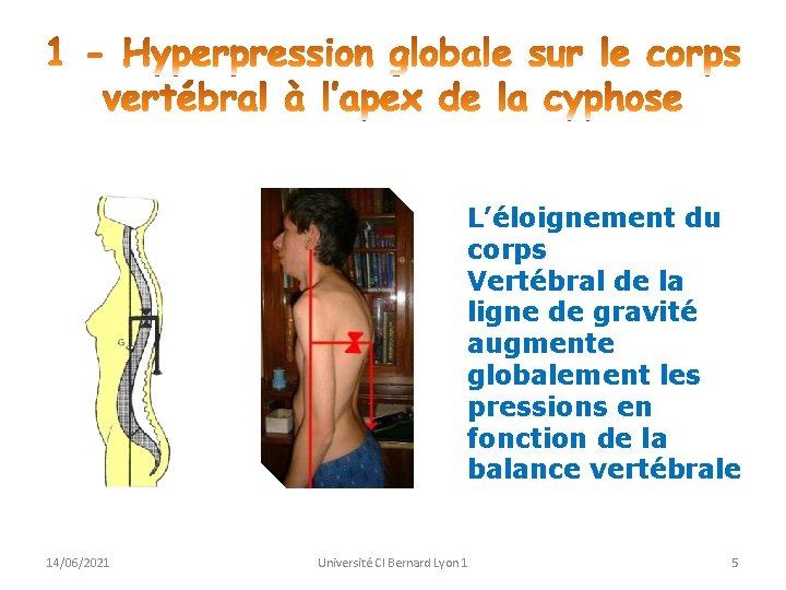 L’éloignement du corps Vertébral de la ligne de gravité augmente globalement les pressions en