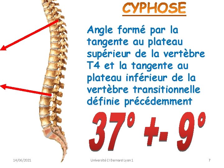 Angle formé par la tangente au plateau supérieur de la vertèbre T 4 et