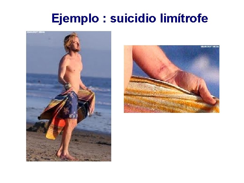 Ejemplo : suicidio limítrofe 