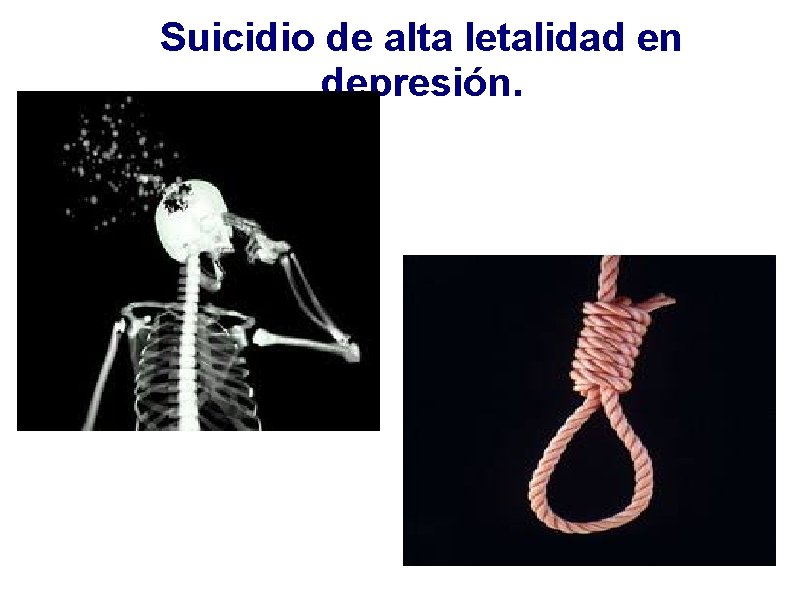 Suicidio de alta letalidad en depresión. 