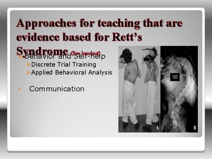 Approaches for teaching that are evidence based for Rett’s Syndrome (See handout) Behavior and