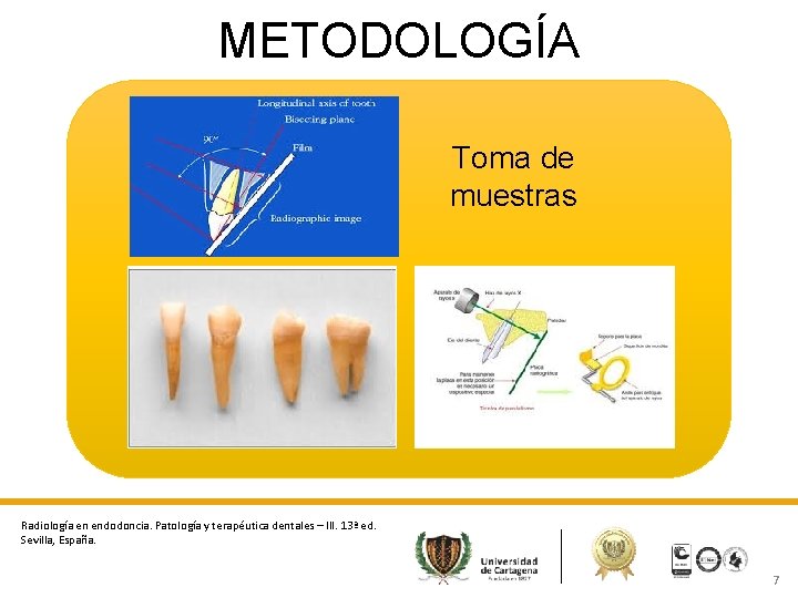 METODOLOGÍA Toma de muestras Radiología en endodoncia. Patología y terapéutica dentales – III. 13ª