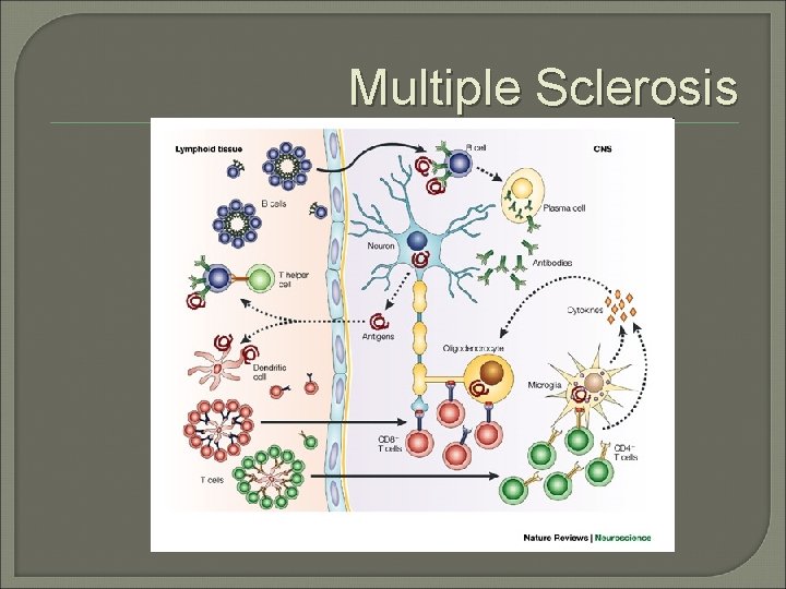 Multiple Sclerosis Multiple Sclerosis