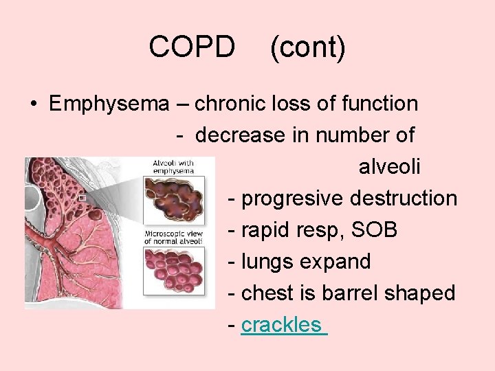 COPD (cont) • Emphysema – chronic loss of function - decrease in number of