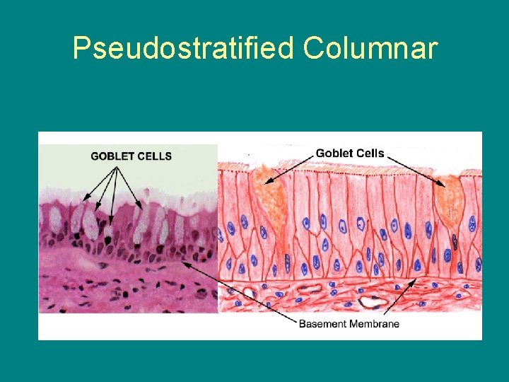 Pseudostratified Columnar 