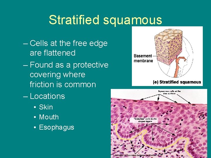 Stratified squamous – Cells at the free edge are flattened – Found as a