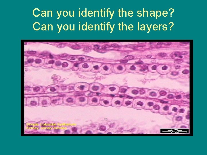 Can you identify the shape? Can you identify the layers? 