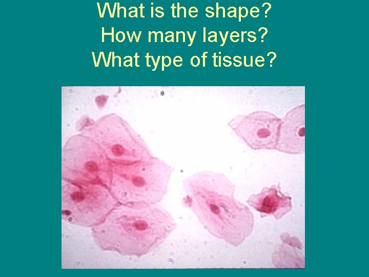 What is the shape? How many layers? What type of tissue? 