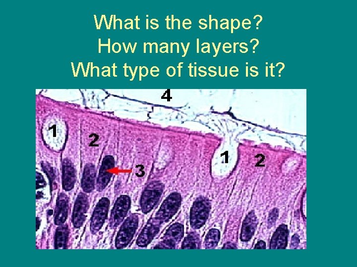 What is the shape? How many layers? What type of tissue is it? 