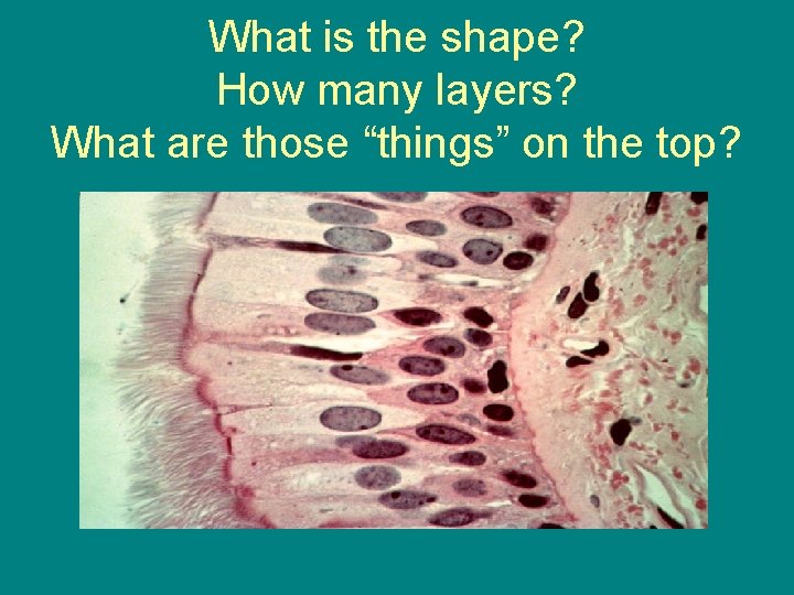 What is the shape? How many layers? What are those “things” on the top?