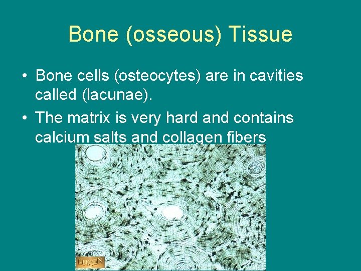Bone (osseous) Tissue • Bone cells (osteocytes) are in cavities called (lacunae). • The