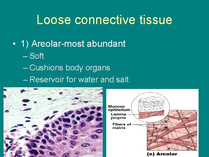 Loose connective tissue • 1) Areolar-most abundant – Soft – Cushions body organs –