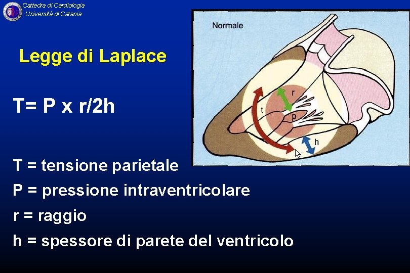 Cattedra di Cardiologia Università di Catania Legge di Laplace T= P x r/2 h