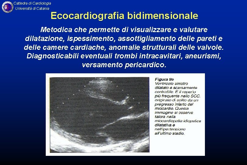 Cattedra di Cardiologia Università di Catania Ecocardiografia bidimensionale Metodica che permette di visualizzare e