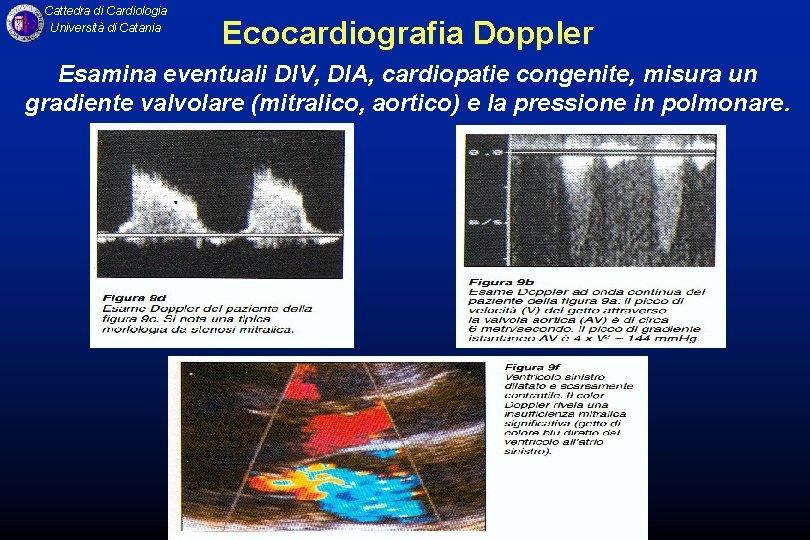 Cattedra di Cardiologia Università di Catania Ecocardiografia Doppler Esamina eventuali DIV, DIA, cardiopatie congenite,