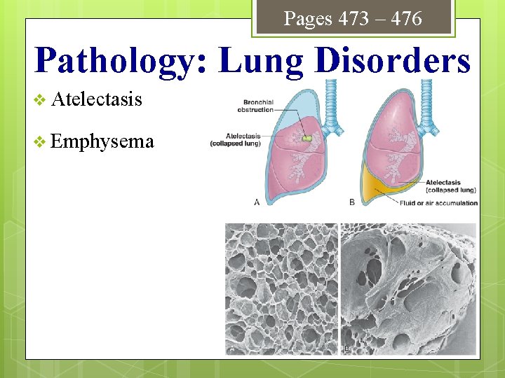 Pages 473 – 476 Pathology: Lung Disorders v Atelectasis v Emphysema 